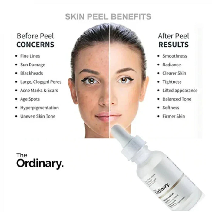 The Ordinary Niacinamide 10% + Zinc 1%